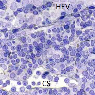 HEV at top, cortical sinus at bottom, brown HRP reaction product in FRCC