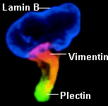 vimentin and plectin redistribute to the uropod after SDF-1a stimulation. Click for Brown et al PubMed